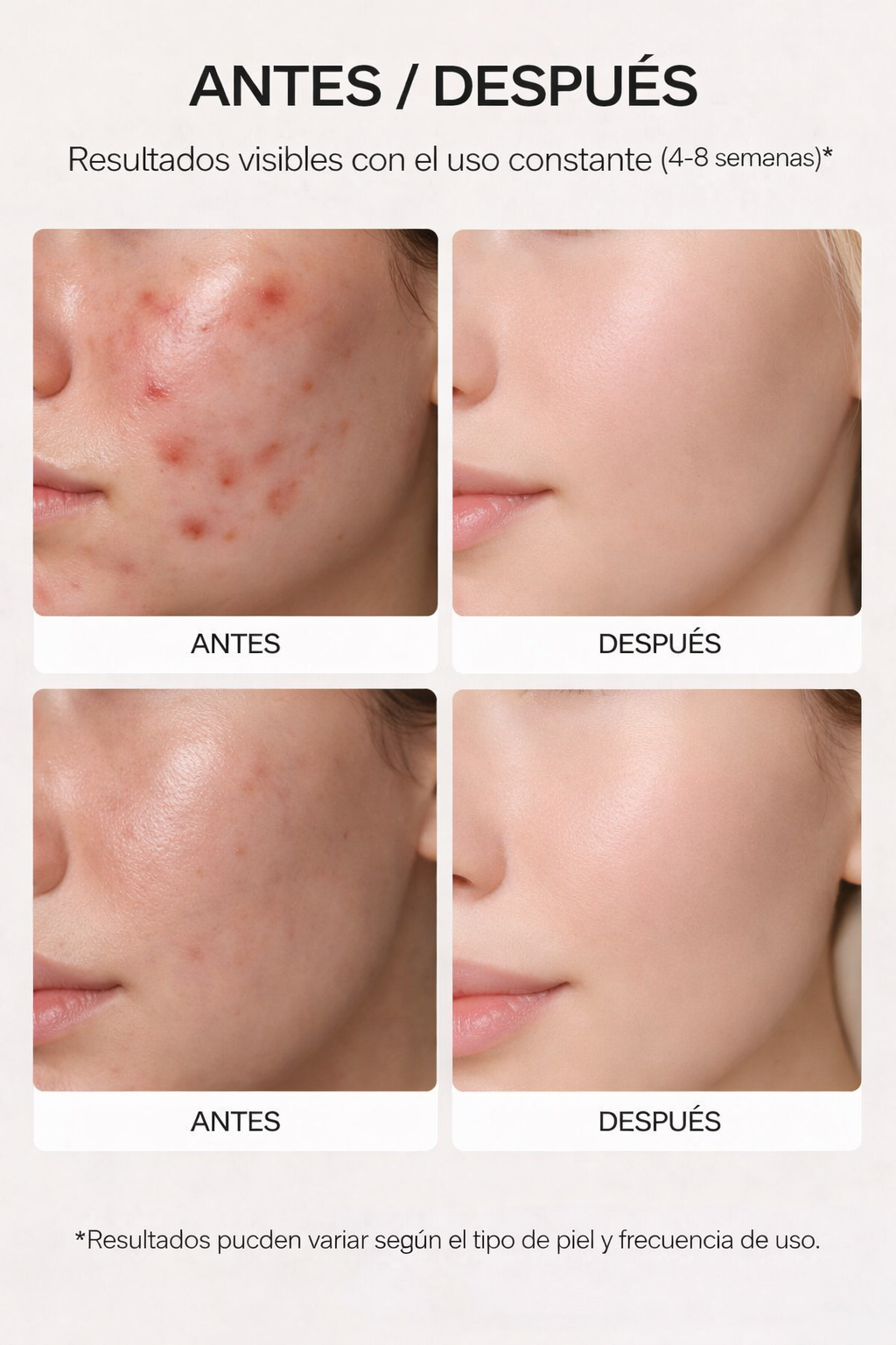 LED Mask Treatment